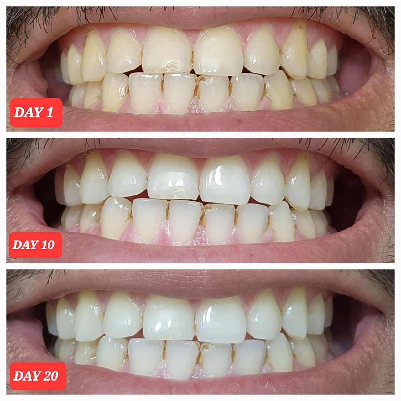 Crest 3D Whitestrips Pro Effects + Bonus 1 Hour Express (Pack de 2) 🎁
